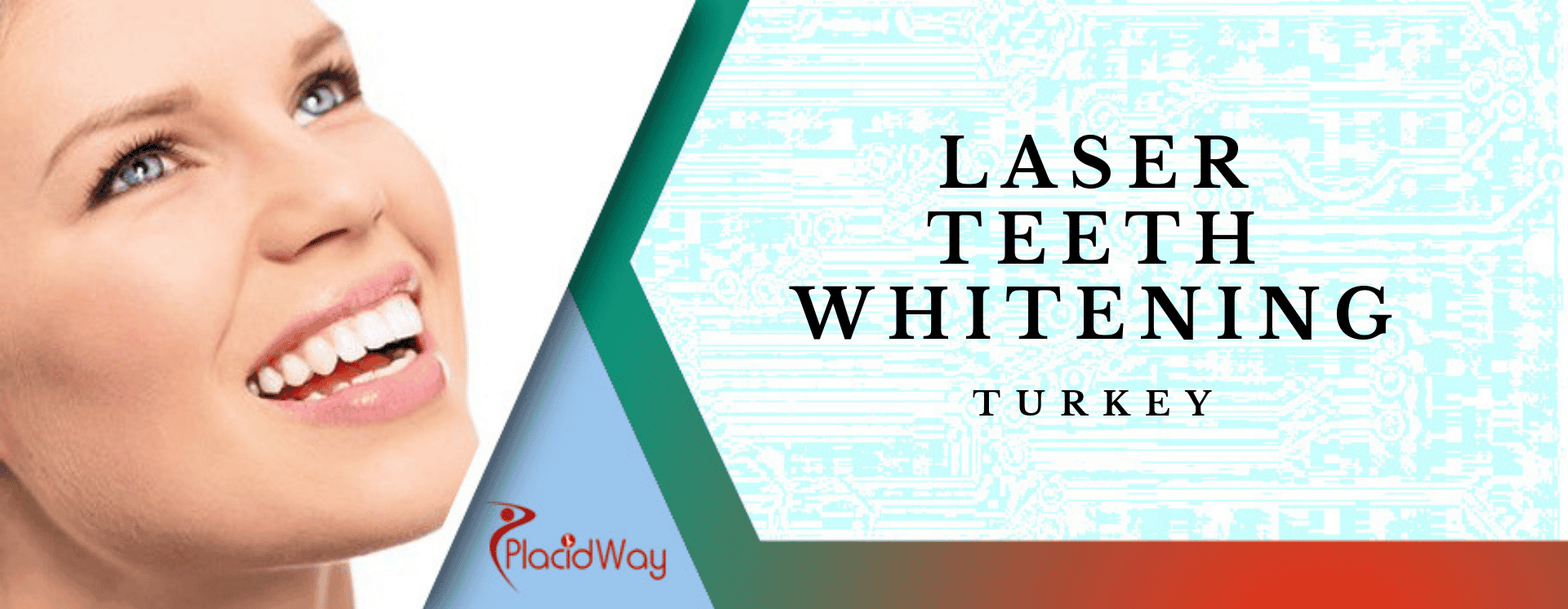 Laser teeth Whitening in Turkey